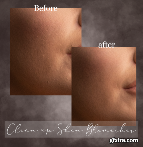 Sweet Soul Studio - Clean up Skin Blemishes