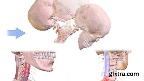 Physiotherapy Management Of Whiplash Injuries