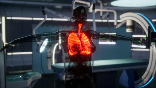 Videohive - Human Lungs Radiology Exam in Laboratory - 47592789 - 47592789