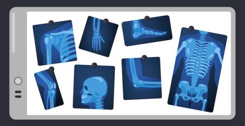 Premium Vector | X ray on doctor screen human skeleton parts on surgery light pad body parts medical xray concept vector illustration bone injuries healthcare skull leg knee and chest scan pictures Premium PSD
