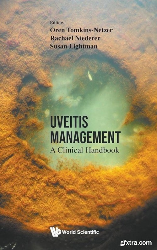 Uveitis Management: A Clinical Handbook 1st Edition (True PDF)