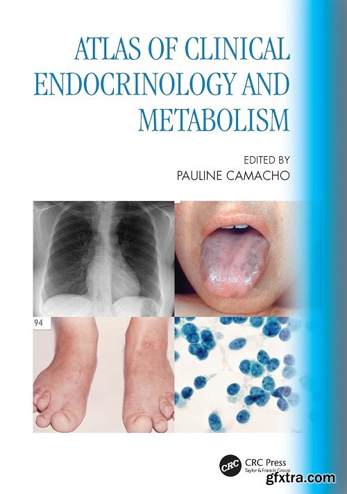 Atlas of Clinical Endocrinology and Metabolism