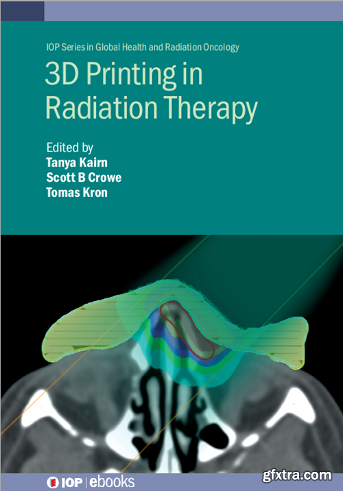 3D Printing in Radiation Therapy