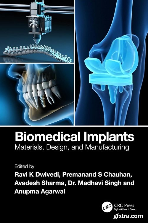 Biomedical Implants: Materials, Design, and Manufacturing