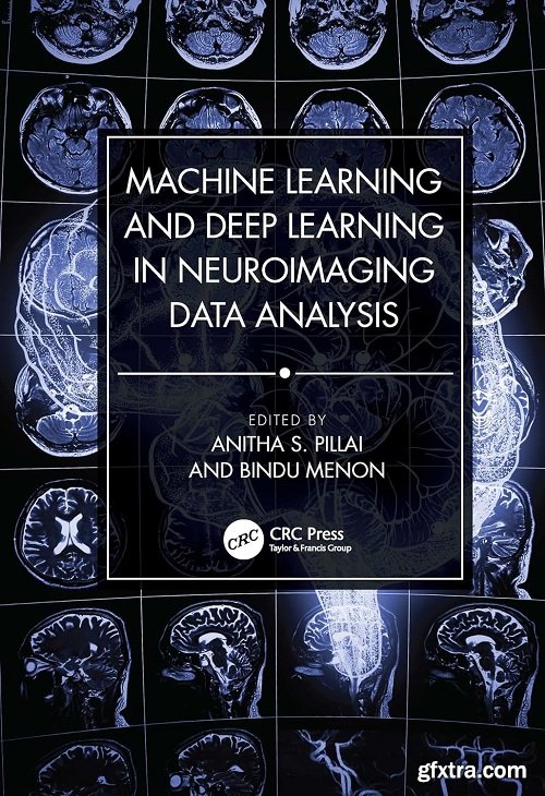 Machine Learning and Deep Learning in Neuroimaging Data Analysis