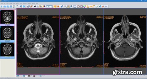 Sante DICOM Viewer Pro 14.0.9