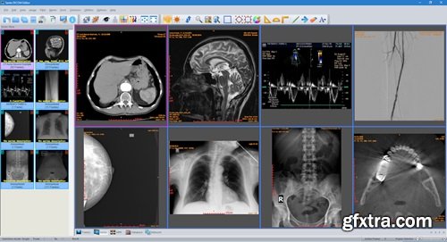 Sante DICOM Editor 10.0.9