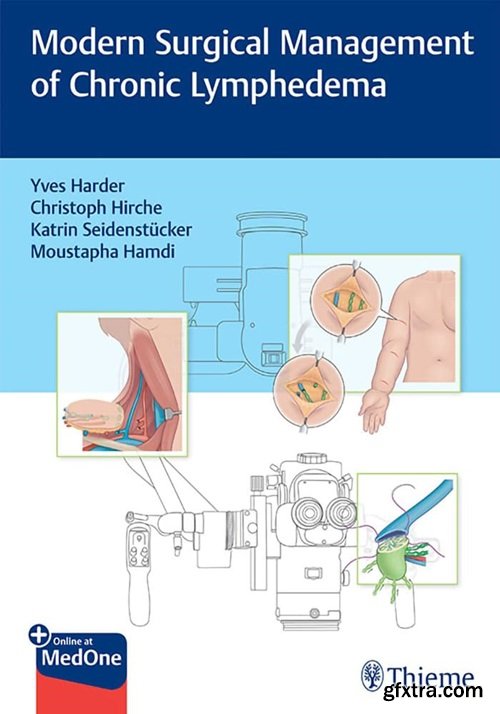 Modern Surgical Management of Chronic Lymphedema