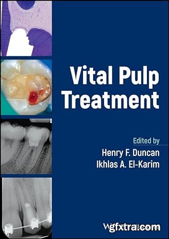 Vital Pulp Treatment