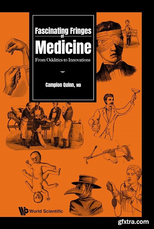 Fascinating Fringes of Medicine: From Oddities to Innovations