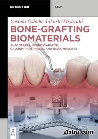 Bone-Grafting Biomaterials: Autografts, Hydroxyapatite, Calcium-Phosphates, and Biocomposites (De Gruyter STEM)