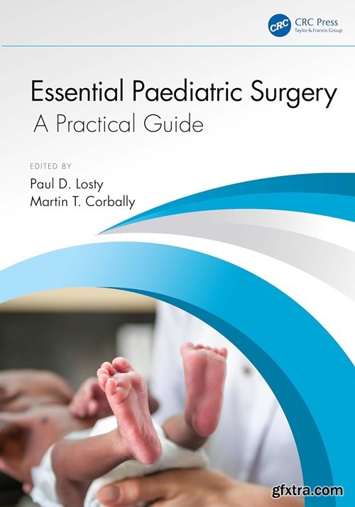 Essential Paediatric Surgery: A Practical Guide