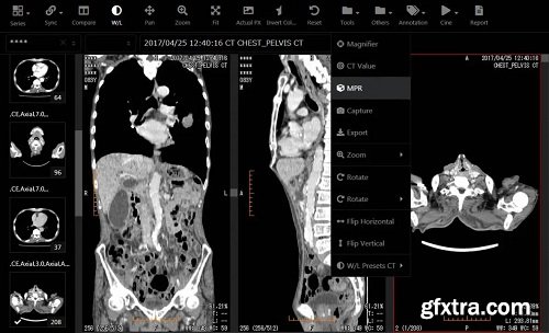 Fujidenolo Solutions SonicDICOM PACS 3.14.1