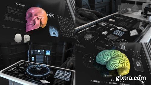 Videohive 200+ Anatomical Infographics 24063143