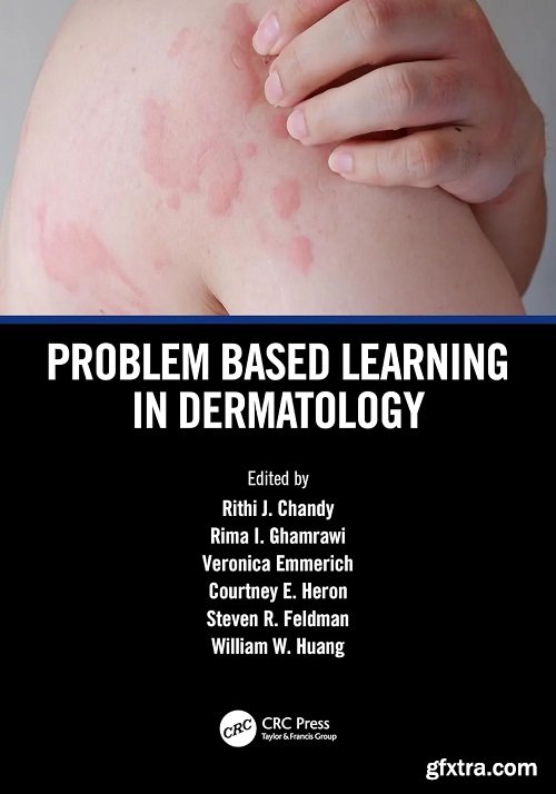 Problem Based Learning in Dermatology