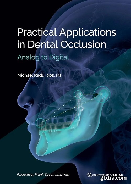 Practical Applications in Dental Occlusion: Analog to Digital