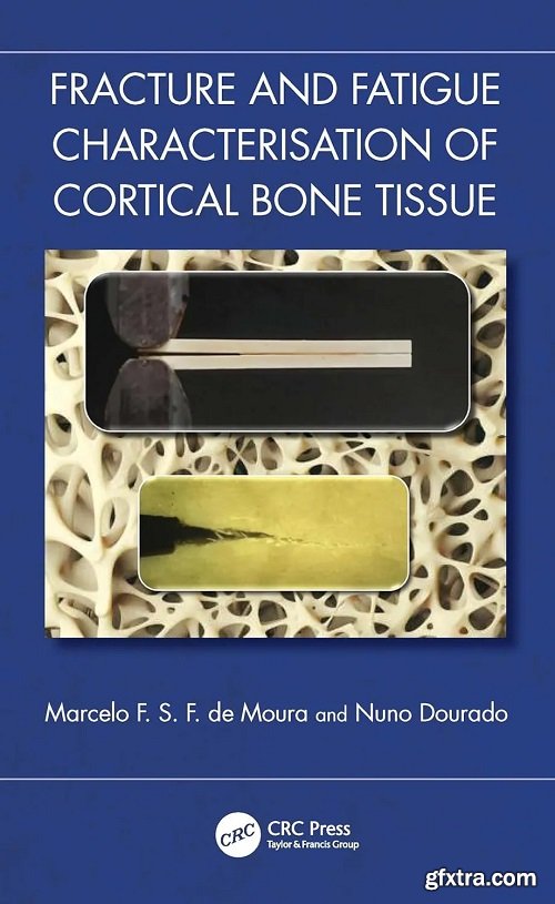 Fracture and Fatigue Characterisation of Cortical Bone Tissue