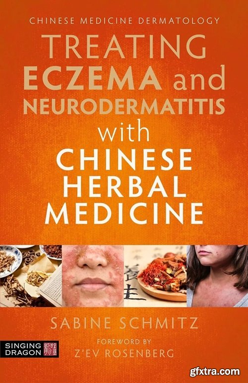 Treating Eczema and Neurodermatitis with Chinese Herbal Medicine