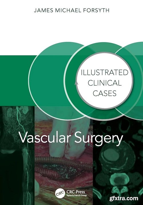 Vascular Surgery:: Illustrated Clinical Cases