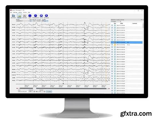 AIT Encevis 2.0.4