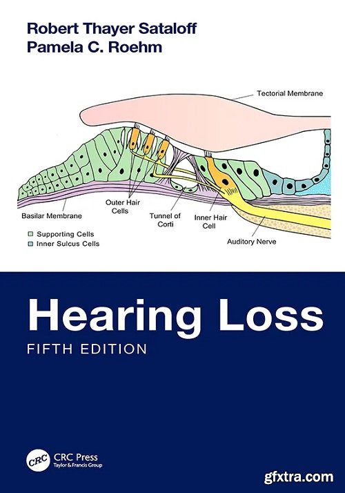 Hearing Loss, 5th Edition