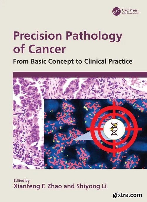 Precision Pathology of Cancer: From Basic Concept to Clinical Practice