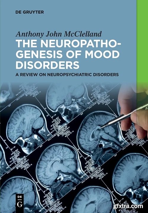 The Neuropathogenesis of Mood Disorders: A Review on Neuropsychiatric Disorders