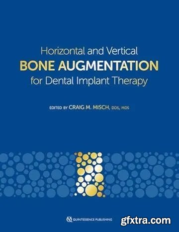 Horizontal and Vertical Bone Augmentation for Dental Implant Therapy