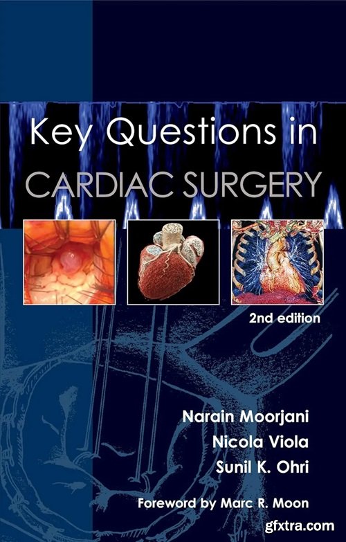 Key Questions in Cardiac Surgery, 2nd Edition