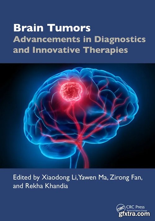 Brain Tumors: Advancements in Diagnostics and Innovative Therapies