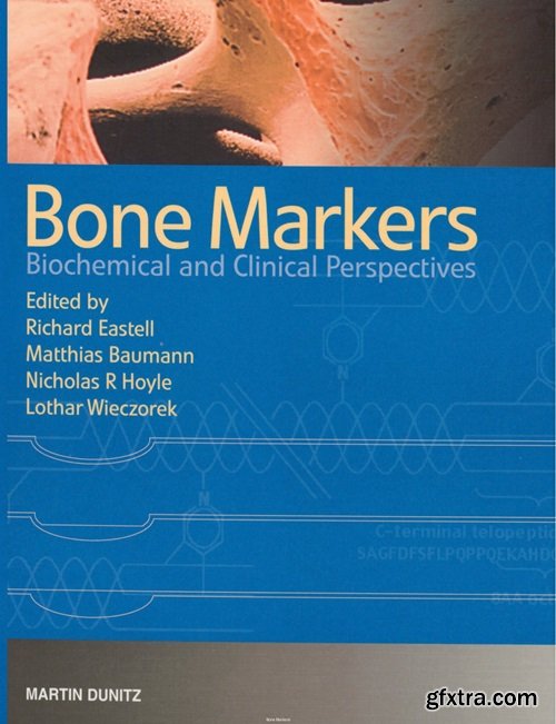 Bone Markers: Biochemical and Clinical Perspectives