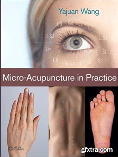 Micro-Acupuncture in Practice