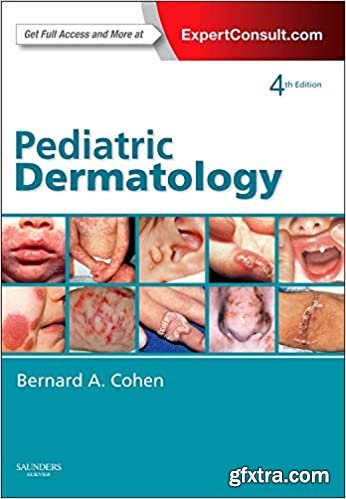 Pediatric Dermatology: Expert Consult - Online and Print (Cohen, Pediatric Dermatology)