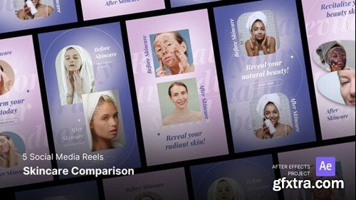 Videohive Social Media Reels - Skincare Result Comparison After Effects Project Files 55392517