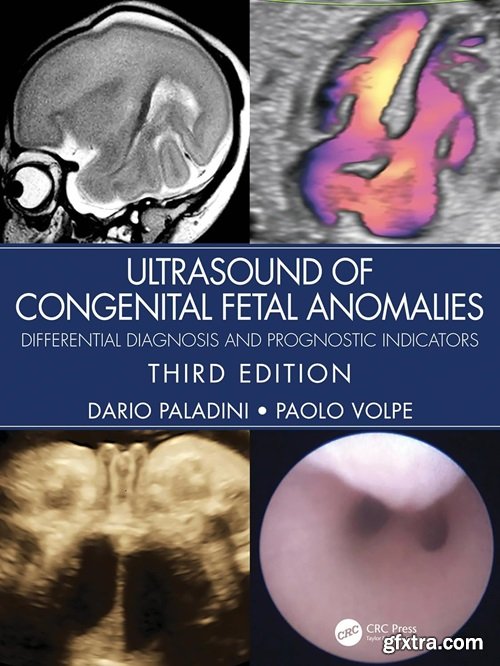 Ultrasound of Congenital Fetal Anomalies: Differential Diagnosis and Prognostic Indicators, 3rd Edition