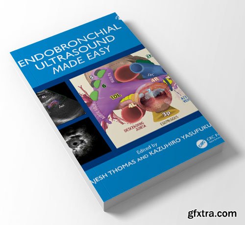 Endobronchial Ultrasound Made Easy
