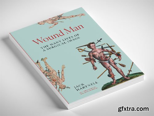 Wound Man: The Many Lives of a Surgical Image
